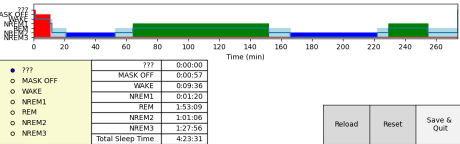 File:E2 2 cycles.webp - Polyphasic Sleep Wiki